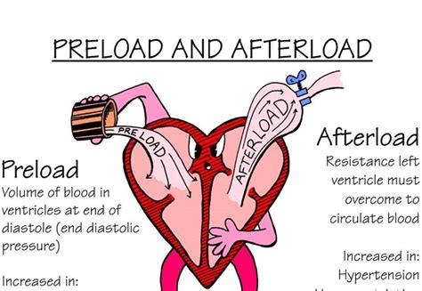 preload vs afterload contractility